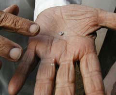 Live Cochineal in the Hand